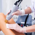 Laser Hair Removal