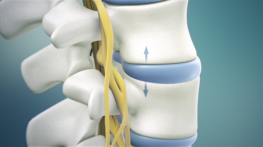 Lumbar Spinal Decompression