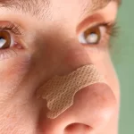 benefits-of-nasal-strips