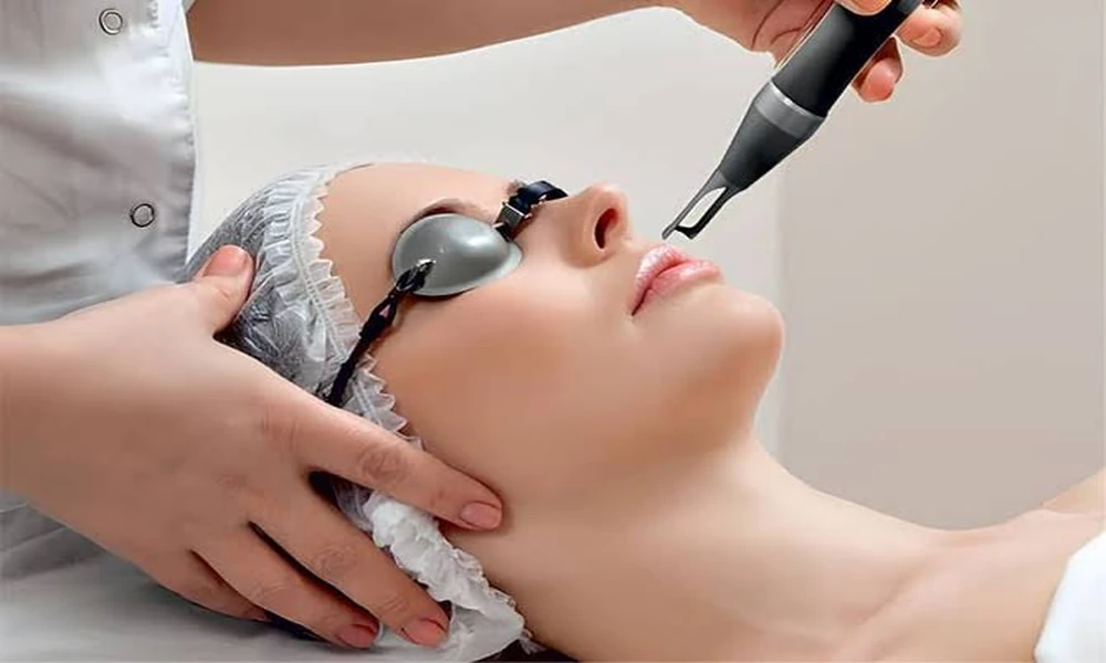 Pico Laser: Improving Uneven Skin Tone and Pigmentation Through Advanced Technology